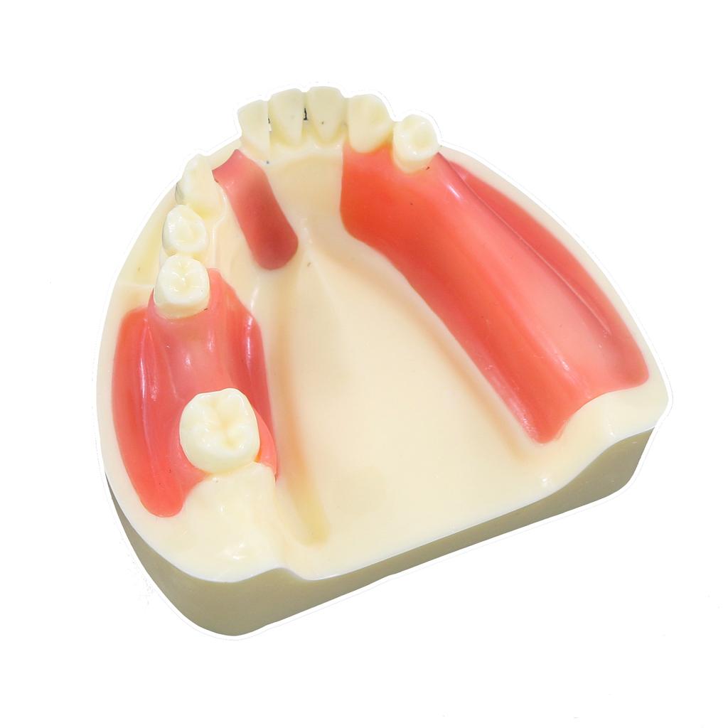 Dental Model Dentistry Implant Practice Training Model For Cutting Implant And Suturing Practice with Cancellous Bone Dental Lab