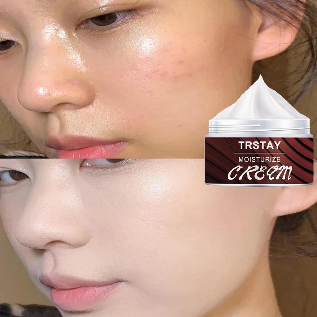 Face Whitening Essence Cream, Brighten and Repair Skin, Even Skin Color, Moisturizing and Moisturizing Cream
