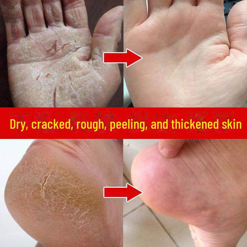 Horse Oil Foot & Hand Cream 250ml - For Cracked Heels, Peeling Skin, Anti-Cracking.