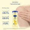 Vaseline Intensive Care Hand Cream & Body Lotion Set