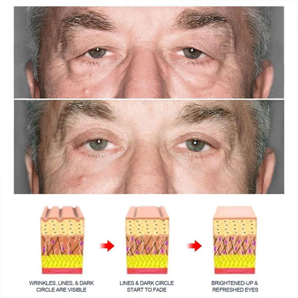 Крем для лица Лифтинг Антивозрастной Против Мешков Под Глазами Увлажнитель Уход за кожей лица