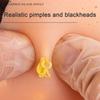Man Head Pimple Popping Toy with Tweezers Anxiety Stress Relief Acne Popping Cleansing Fidget Toy Blackheads Removal Decompression Sensory Toy