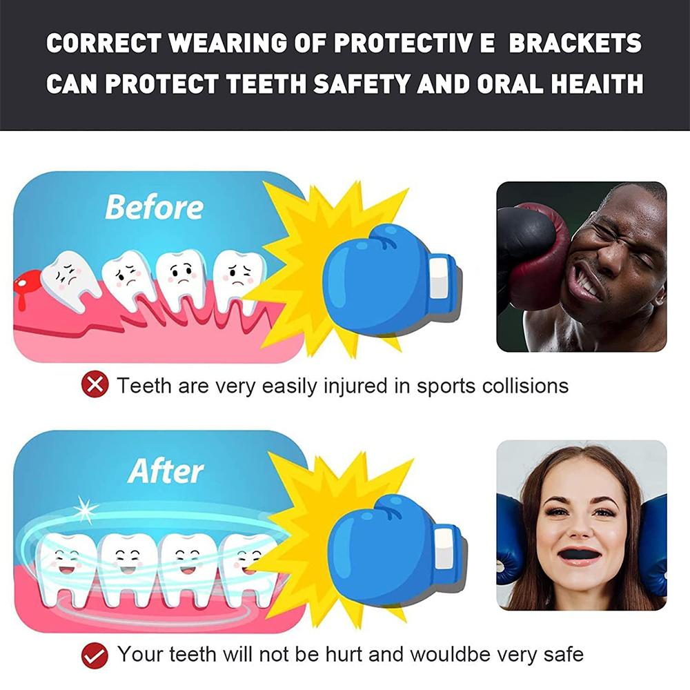 Защитная капа для рта, профессиональная капа для контактных видов спорта, регби, 2 шт.