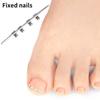 1 шт., инструмент для коррекции вросшего ногтя, невидимый вросший палец, эластичный зажим для выпрямления ногтей, инструмент для педикюра