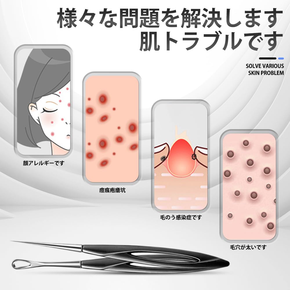 Игла от акне Удаление акне Комедоны Черные точки Уход за порами Красота Унисекс Игла для клеток 1 Набор клеток, Инструмент, Экстрактор, Удалитель, Ультратонкий наконечник, Набор, Инструмент, (1 +