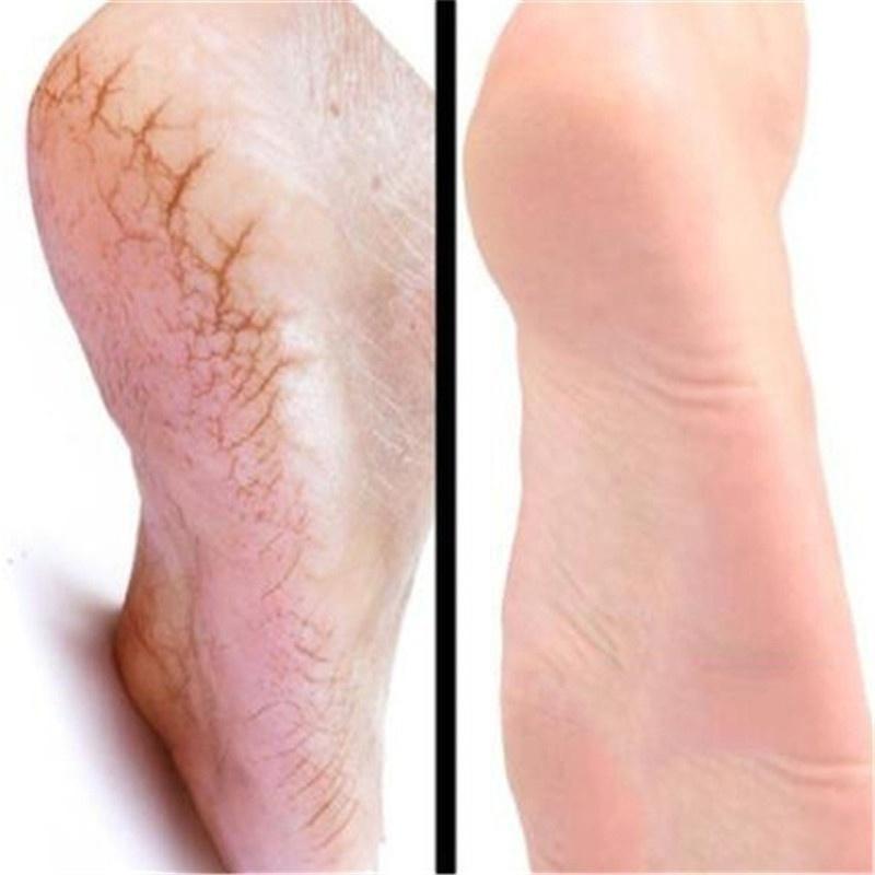 Крем для восстановления рук и ног с лошадиным маслом. Крем для ухода за ногами. Крем для ухода за бери-бери и зудом на ногах.