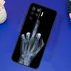 Чехол-скелет со средним пальцем для OPPO A17 A57 A77 A78 A15 A16 A52 A72 A76 A96 A74 A94 A5 A9 A31 A93 A54S A53S A57S