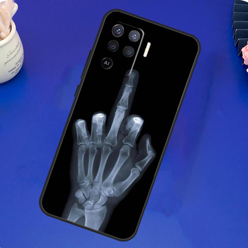 Чехол-скелет со средним пальцем для OPPO A17 A57 A77 A78 A15 A16 A52 A72 A76 A96 A74 A94 A5 A9 A31 A93 A54S A53S A57S
