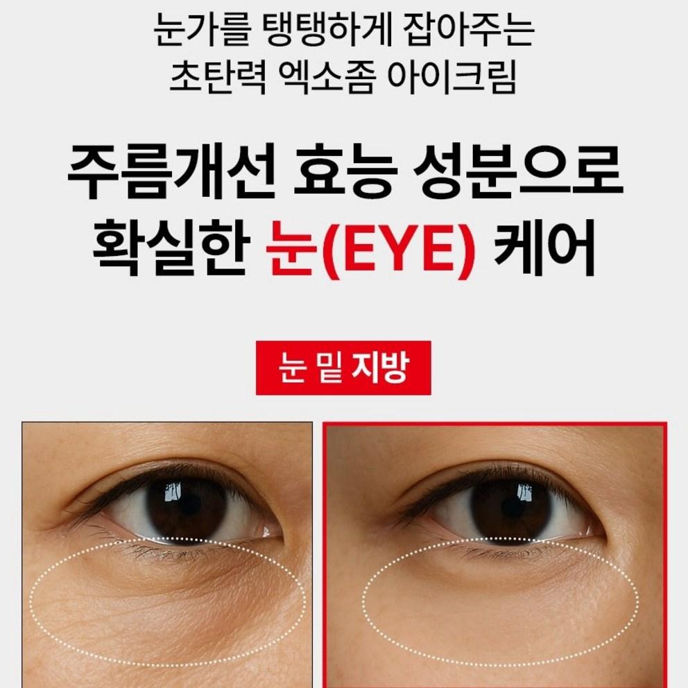 [Victonine] ExoSome Eye Cream, Lifting Peptide, Under Eye Fat Wrinkle Improvement, 40ml