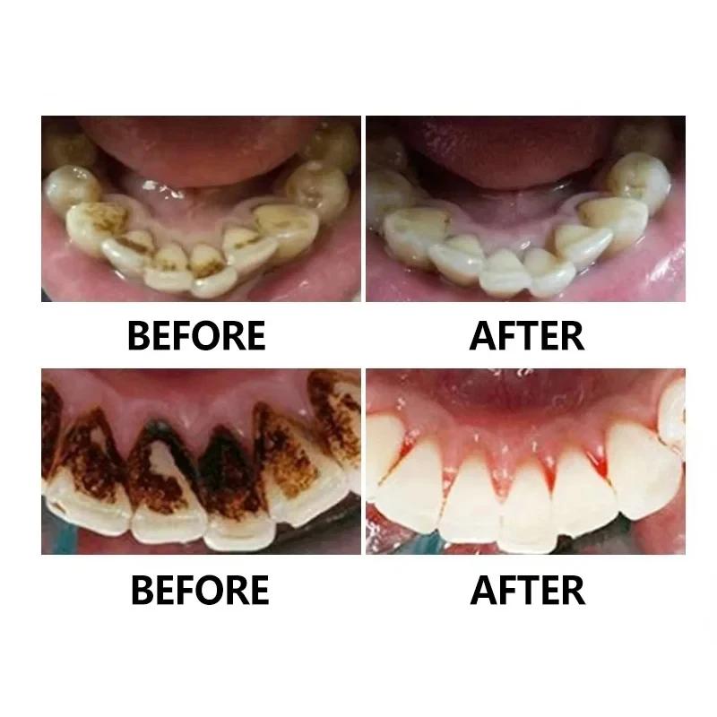 Dental Mirror Stainless Steel Dental Dentist Prepared Tool Set Probe Tooth Care Kit Instrument Tweezer Hoe Sickle Scaler