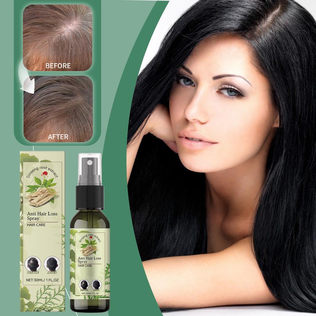 Herbal Hair Growth Spray Activates Hair Follicles, Reduces Hair Loss And Breakage, Improves Hair Quality, Nourishes Hair And Promotes Hair Growth,30ML