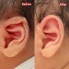 1Pcs Baby Auricle Support External Auricle Corrector Protruding Baby Ear Corrector Baby External Auricle Corrector Ear Pads