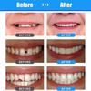 1 комплект для ремонта зубов для женщин и мужчин, временный комплект для замены зубов, формованные термофитинговые бусины для заполнения, исправления отсутствующих и сломанных зубов или клея