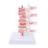 Professional Osteoporosis Model Human Anatomical Spine Model for Teaching Demonstration