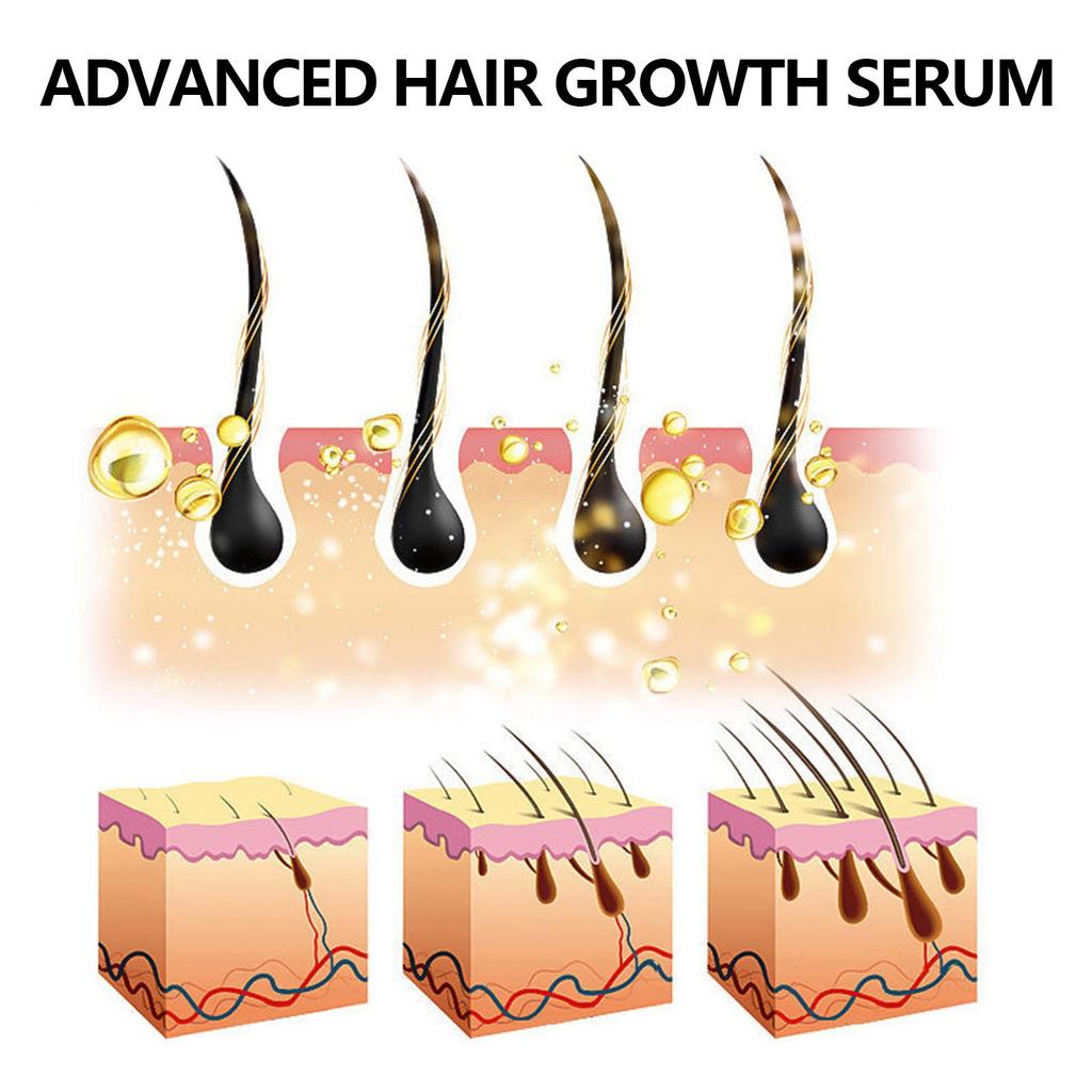 Hair Thickening  Repairs Thick  Nourishes Hair Strengthens Hair Careoil 30ml