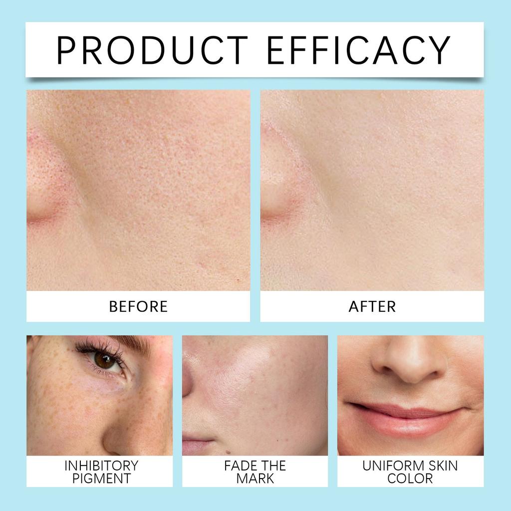 Никотинамид Глицерин Сыворотка Вода Мягкий Контроль над жирностью Увлажнение Питает Нежную Кожу Увлажняющий Компресс Сыворотка Тоник