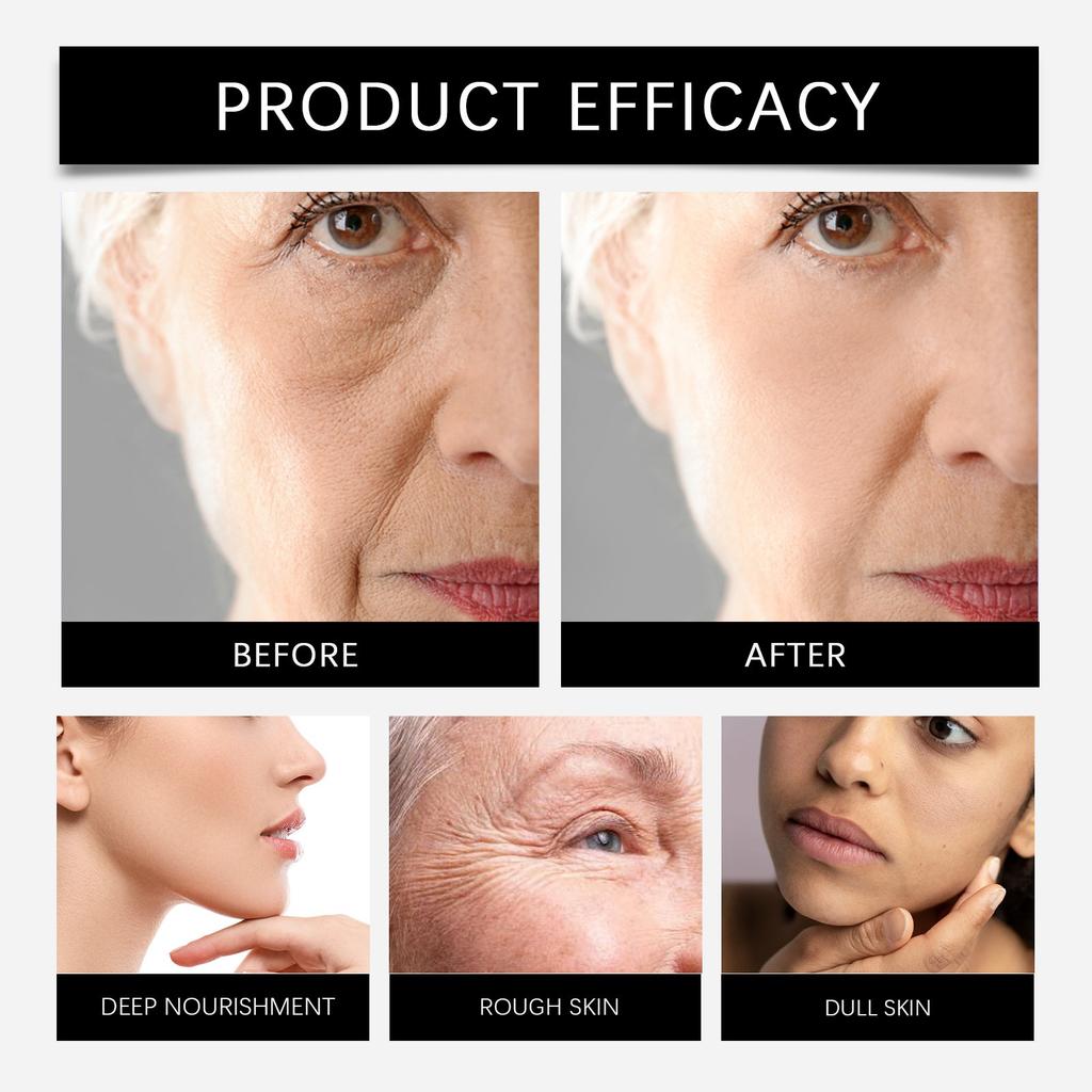 The Lifting Cream Tightens The Skin Deeply Hydrates, Moisturizes, Brightens And Improves Dull Complexion