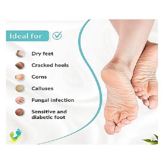 Fixderma Foobetik Cream Крем для ног для потрескавшихся ног, увлажняющий и восстанавливающий 50г