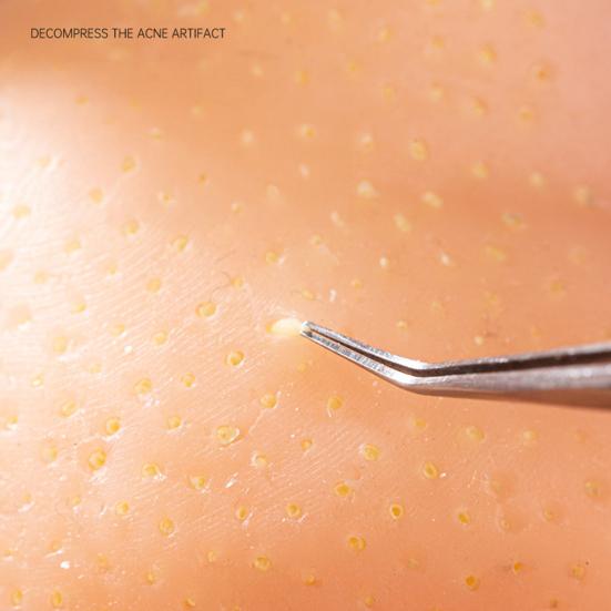 Игрушка для выдавливания прыщей на голове человека с пинцетом, средство для снятия тревоги и стресса, выдавливание акне, очищение, непоседа, удаление черных точек, декомпрессионная сенсорная игрушка