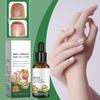 Nail Care Liquid: Soft And Thick Nails, Cleaning, Nourishing And Protecting Nails, Perinail Care Liquid,30ML