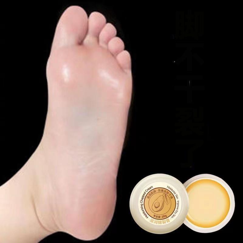 Крем для ног против трещин, восстанавливающий крем для потрескавшейся кожи, восстанавливающий крем для пяток, трещин, шелушения, маска для ног, смягчающий увлажняющий крем для ног, увлажняющий лотин