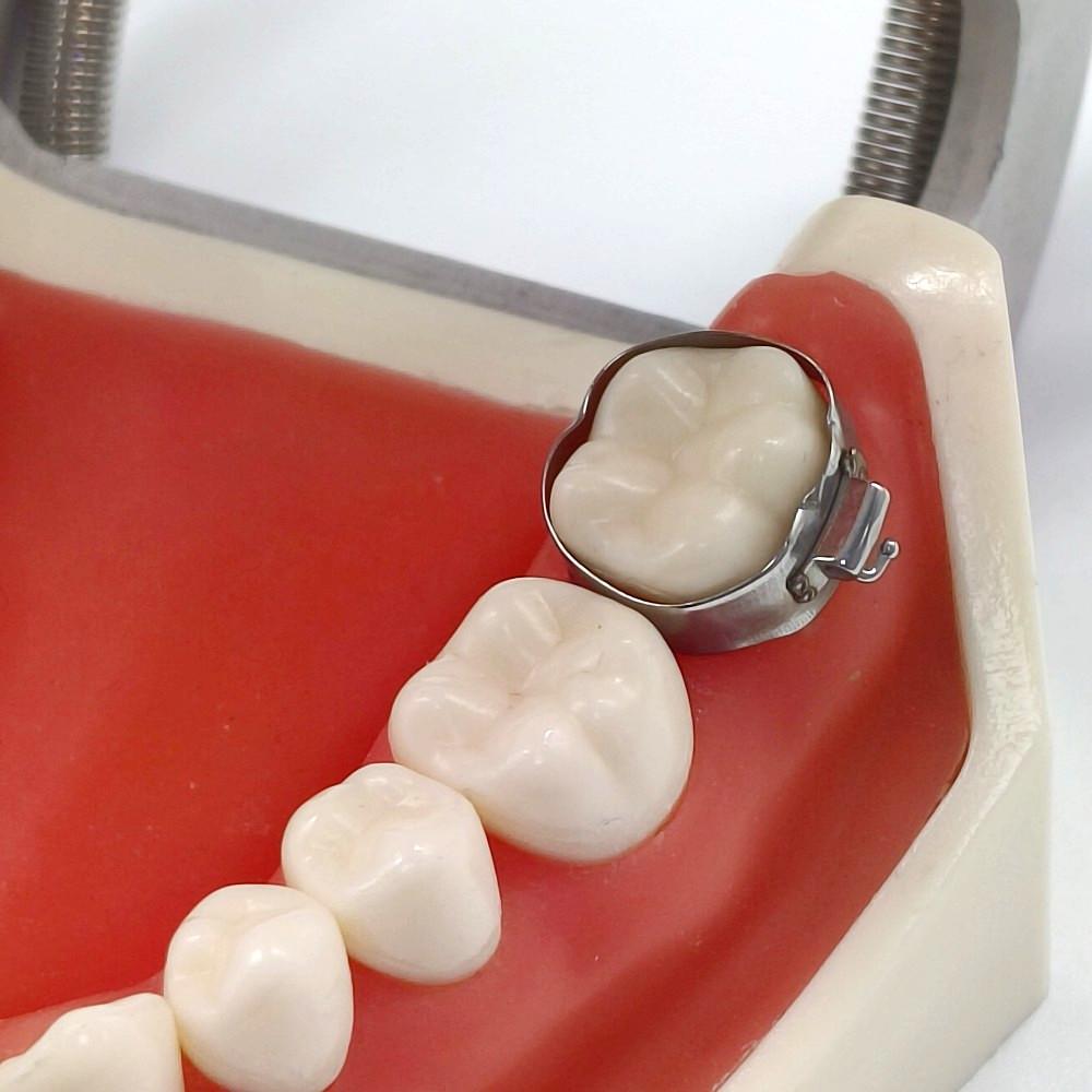 80 шт./кор., стоматологический ортодонтический молярный браслет с буккальными трубками, ортодонтический браслет из нержавеющей стали с трубкой, материалы для стоматолога