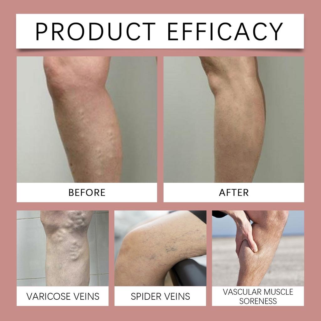 Body Care Soothing Cream Gentle Care For Leg Discomfort Daily Moisturizing Massage Cream