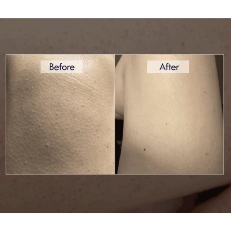 [Purdell] Крем для восстановления EGF с мочевиной 70000ppm 50 мл