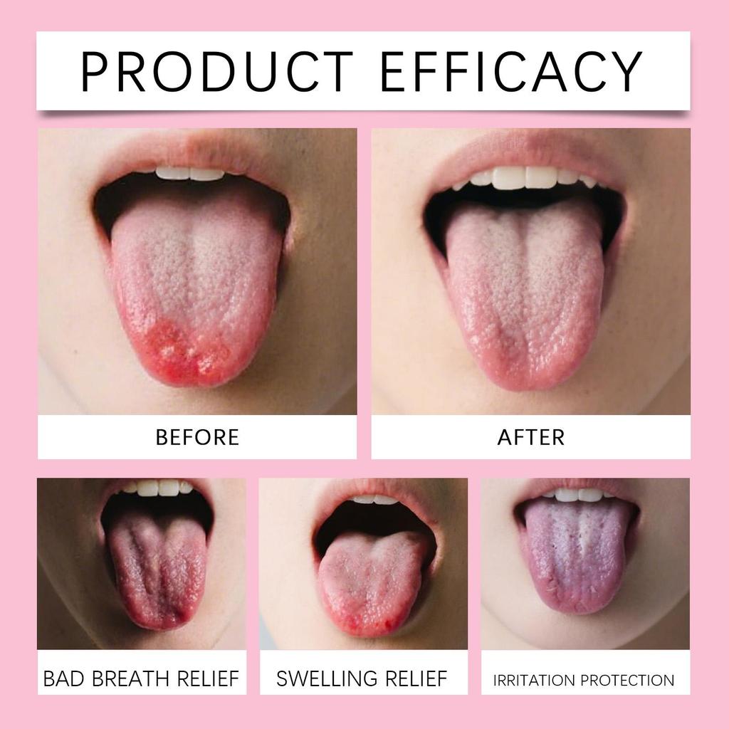 Oralhoe 2-in-1 Tongue Cleaning Gel (with Tongue Brush) – Tongue Coating Removal, Fresh Breath, Oral Care & Hygiene, Complete Tongue Cleaning Kit