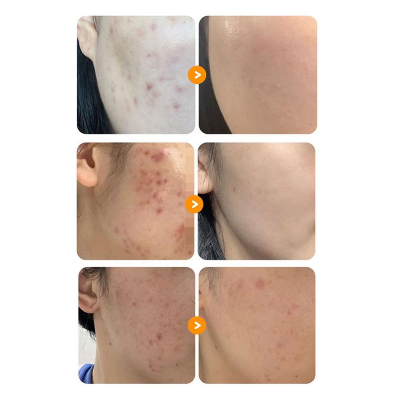 NUMBUZIN Нет. 5 Прощай, сыворотка от пятен, 50 мл (2 варианта)