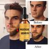 Beard Oil Hair Growth Beard Growth Hair Oil for Fast Hair Growth