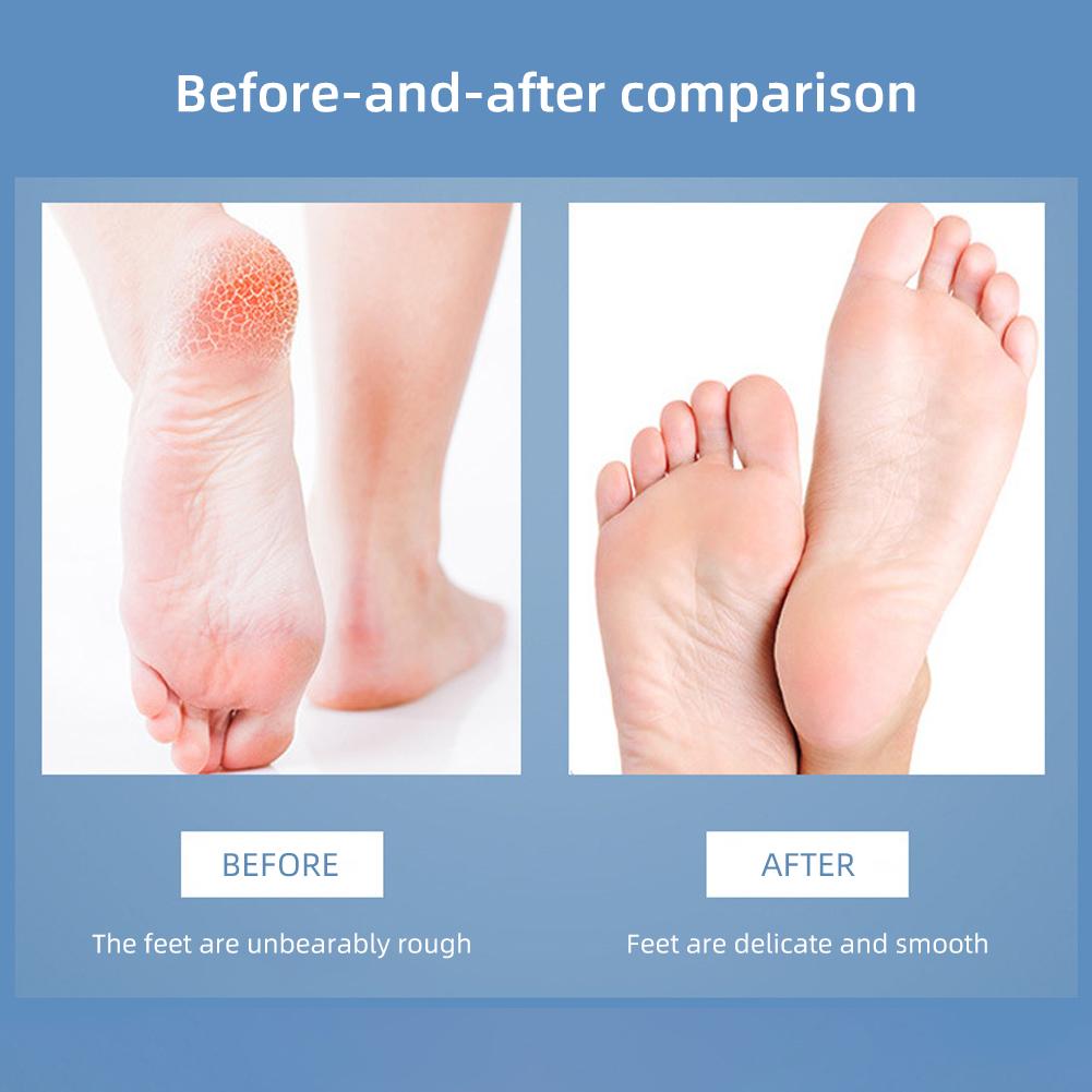 3-в-1 шлифовальная машинка для ног из нержавеющей стали, отшелушивающая пилка для ног, моющаяся, прочная, ручная, домашний инструмент для ухода за ногами