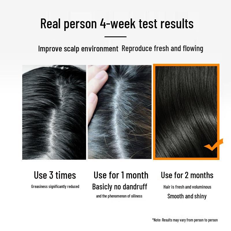 LK Amino Acid Balancing Oil Control Shampoo