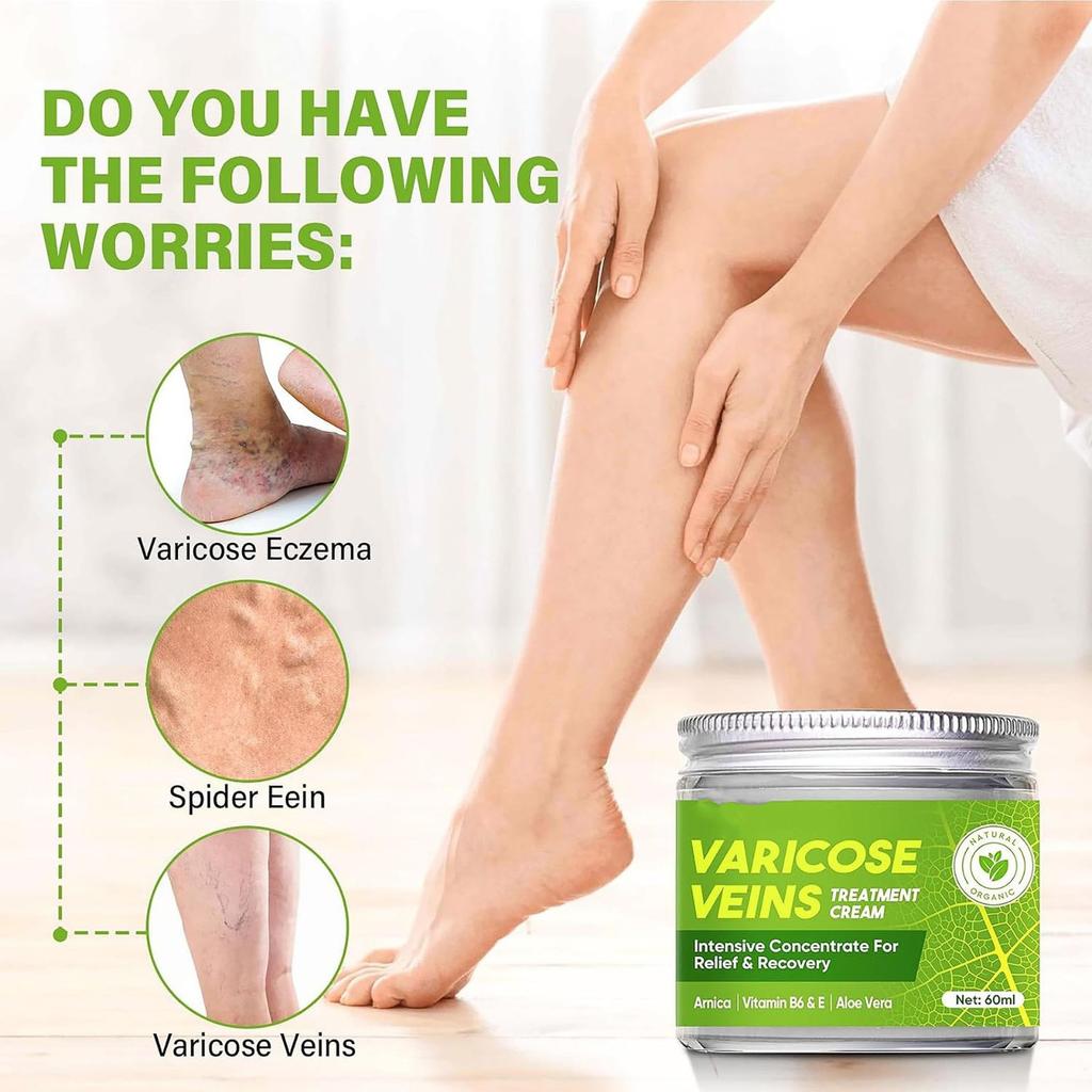 Крем для успокоения вен, крем для восстановления ног, улучшает кровообращение и питает гладкую кожу