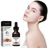 Melanin Correcting Serum Fade Dark Spots Anti Freckle Melasma Remover Lightening Pigment Blemish Vitamin C Face Essence New Arrival S03 less