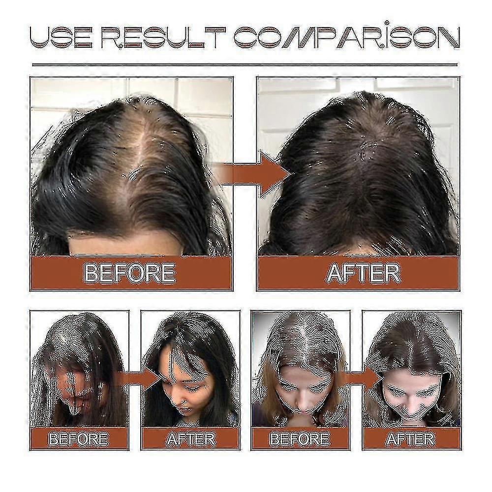 100% Pure Batana Oil From Natural Batana Butter For Hair Growth Alopecia Areata Hair Loss Treatment For Men Wome - HE