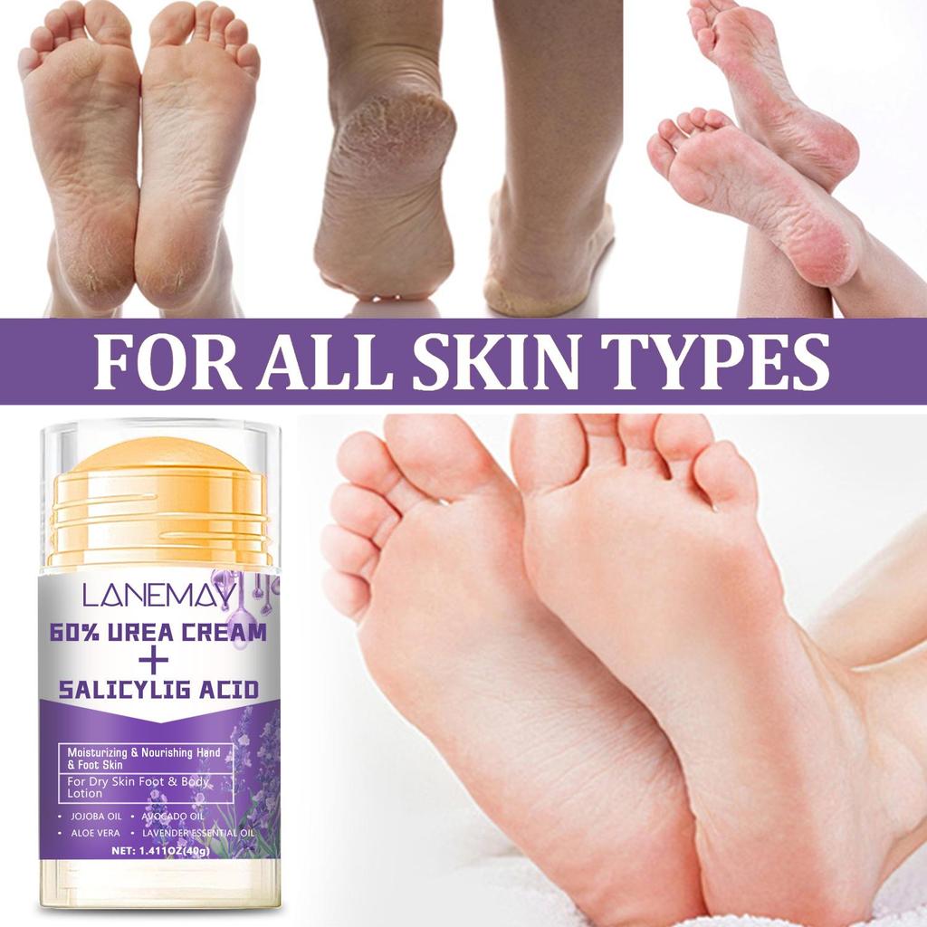 UREA & SALICYLIC ACID STICK-Prevent Water Loss and Provide Limited Moisture retention-Deeply Hydrates Skin