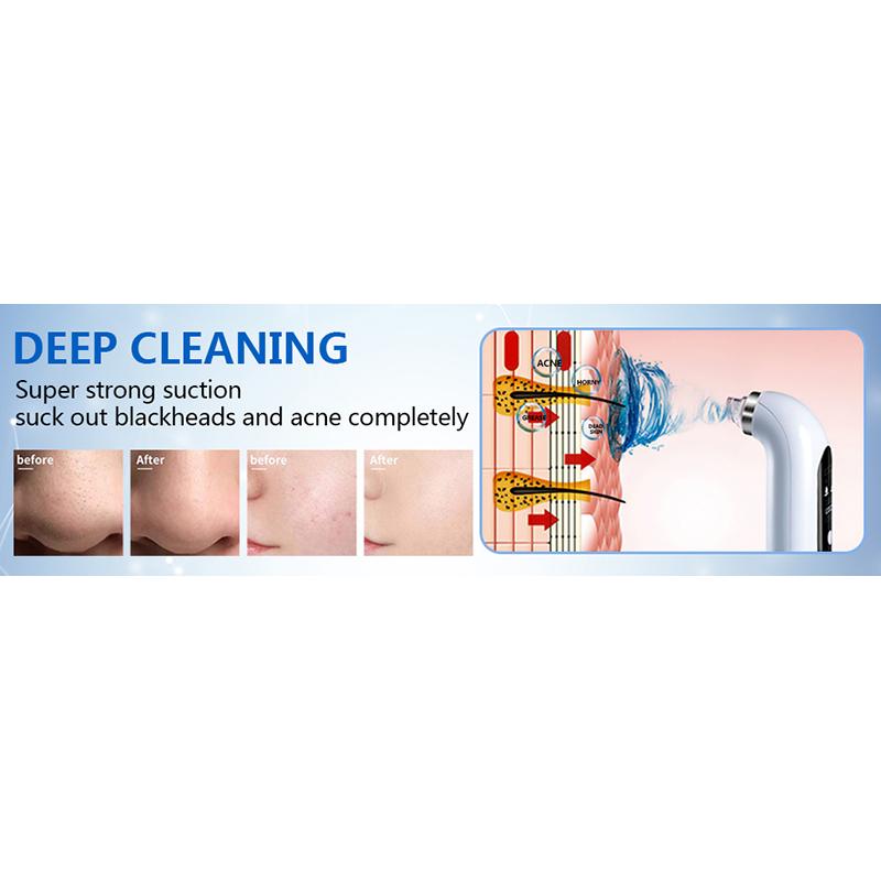 2024 Blackhead Remover Pore Vacuum Cleaner Electric Micro Small Bubble Facial Cleasing Machine USB Rechargeable Beauty Device