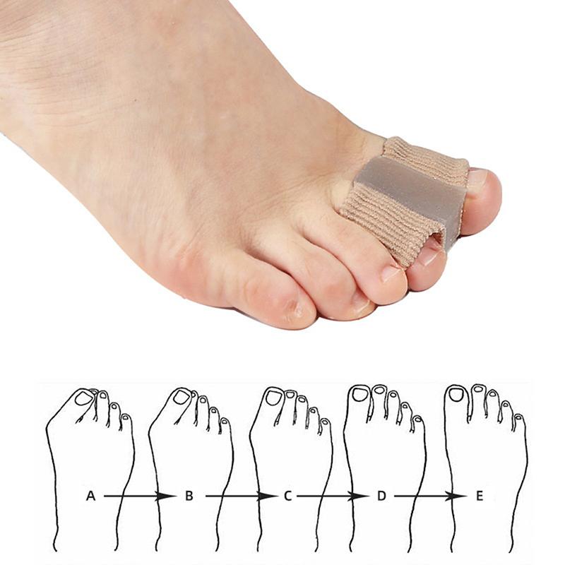 1Pc Spreader New Silicone Bunion Toe Gel Straightener Pain Corrector Separator