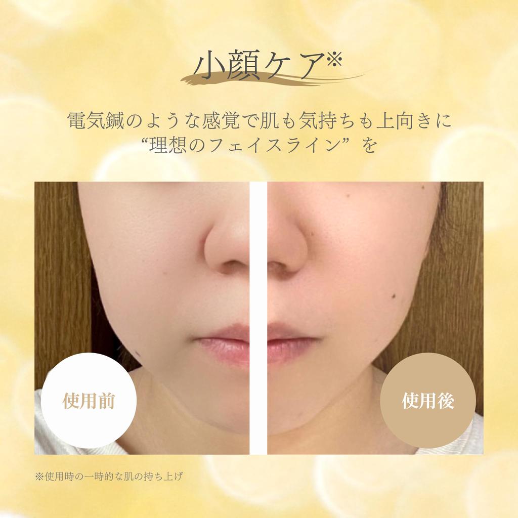 Аппарат для красоты лица EMS Не требуется гель Подтяжка глаз Электропорация Корейский уход за кожей головы Эффективное косметическое средство Простота использования Поры Без хлопка JETty ELF GOLD