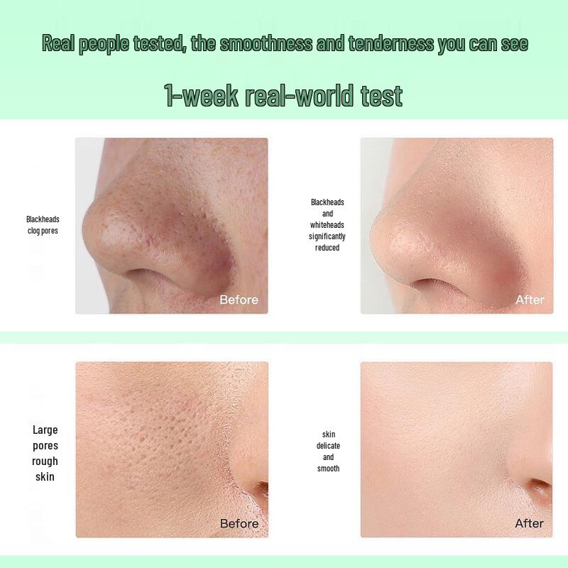 NaSeKi Japan Pore Minimizing & Blackhead Removal Serum