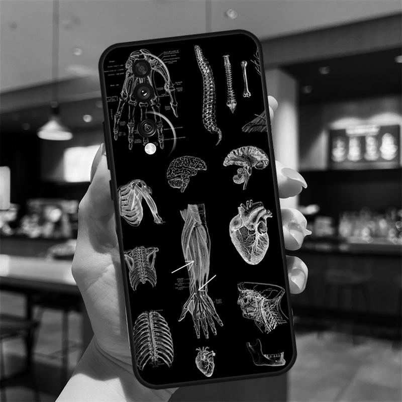Medical Skeleton Anatomy Case For Honor Magic 8 6 7 Pro Honor 400 200 70 90 Lite X8b X8c X9a X9b X9c X9d Win RT Cover