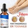 Repair Nail Fungus Treatments Essence Foot Care Serum Toe Nails Fungal Removal Gel Anti-Infection