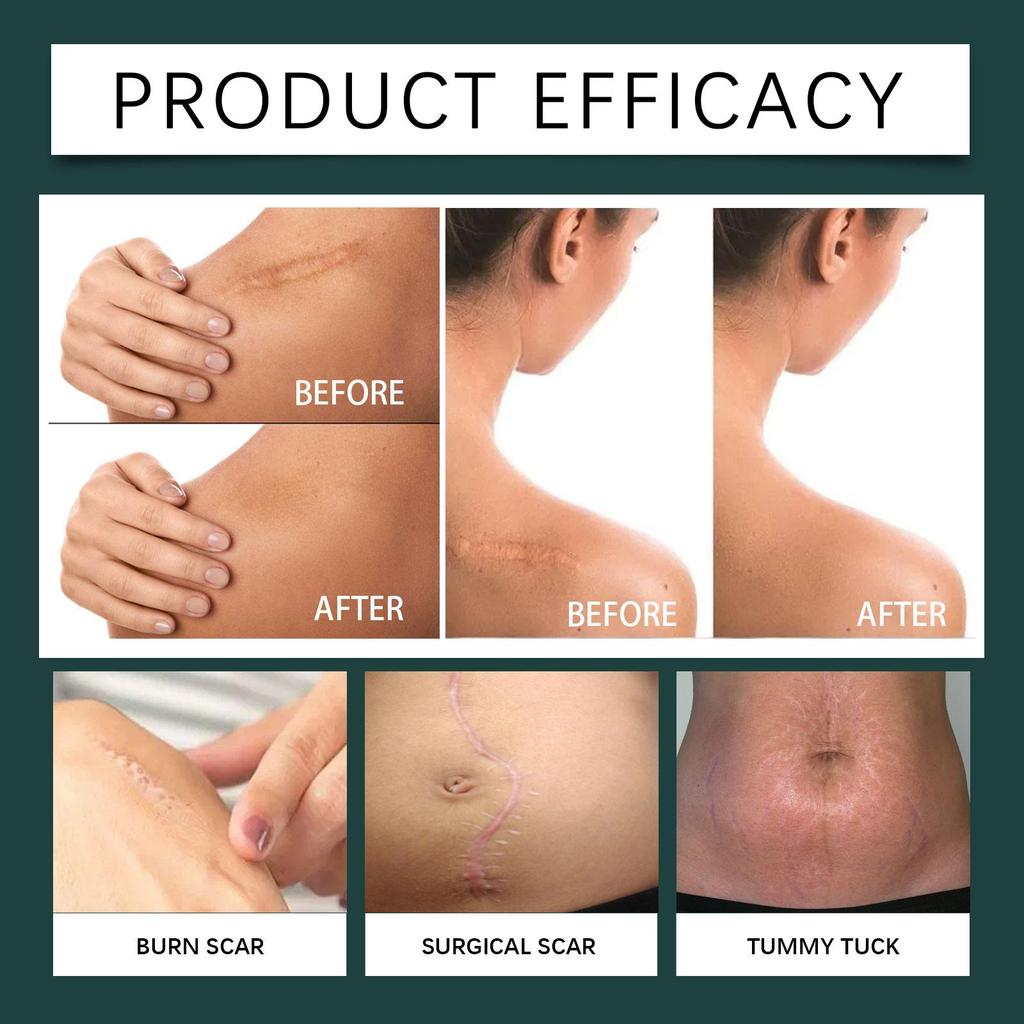 AMZ Skin Care Patches (1 roll), softens and reduces scars, smooths fine lines, gently nourishes and protects the skin, suitable for daily skincare