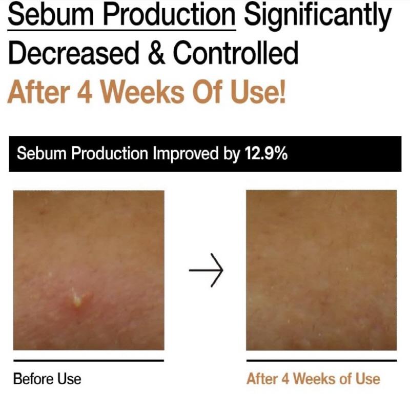 Anua Тоник молочный Rice 70 Glow 250 мл