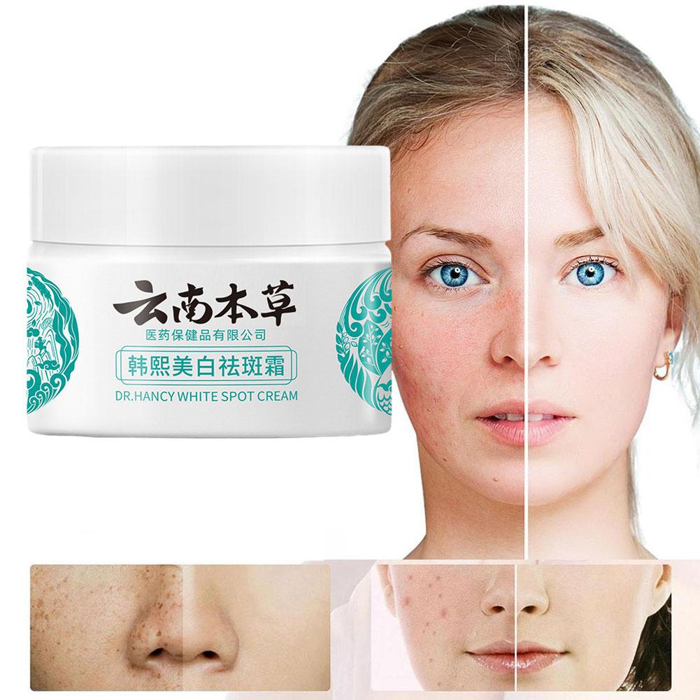 20g Powerful Yunnan Herb Whitening Freckle Cream Remove Face Moisturizing Care Face Dark Spots W8V5