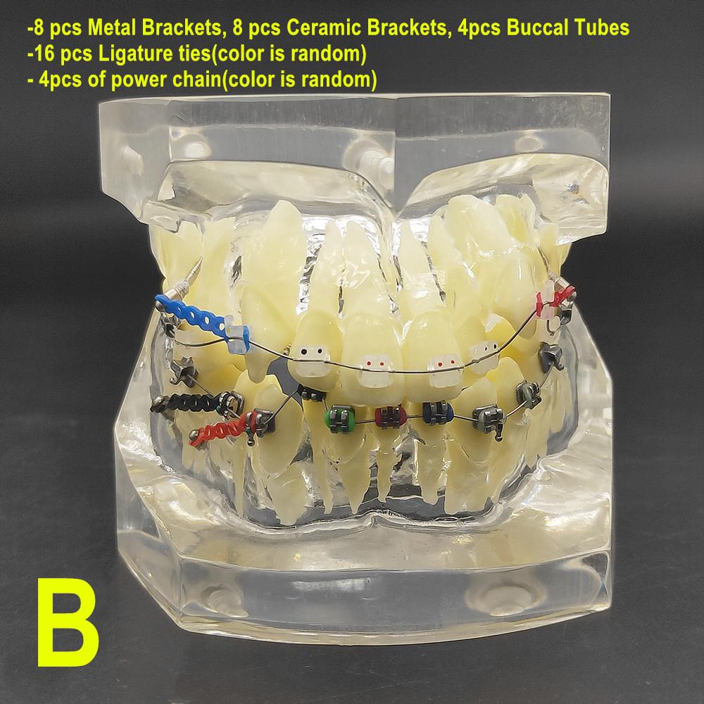 1 шт., прозрачная стоматологическая ортодонтическая модель прикуса с брекетами, буккальная трубка дуги для общения с пациентом