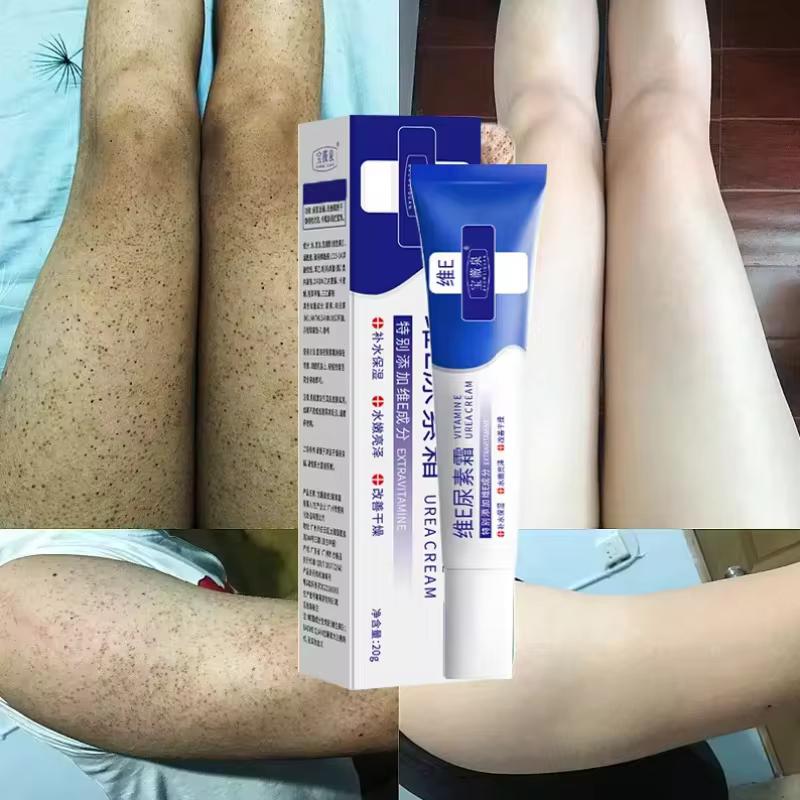 Крем для тела с 10% мочевиной и витамином Е для сухой кожи и лечения кератоза пиларис