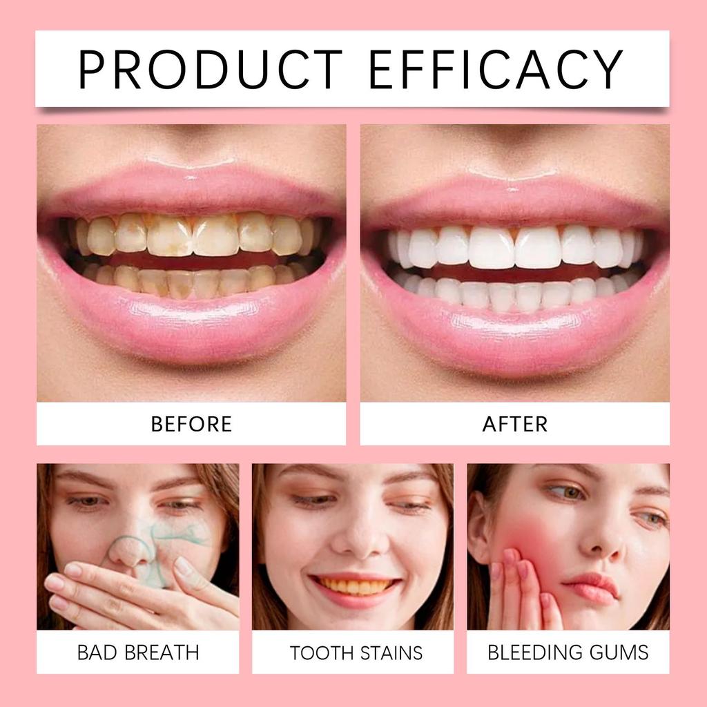 Oralhoe Probiotic Toothpaste Gently Cleans and Cares for Your Teeth To Reduce Stains for Long-lasting Oral Care.
