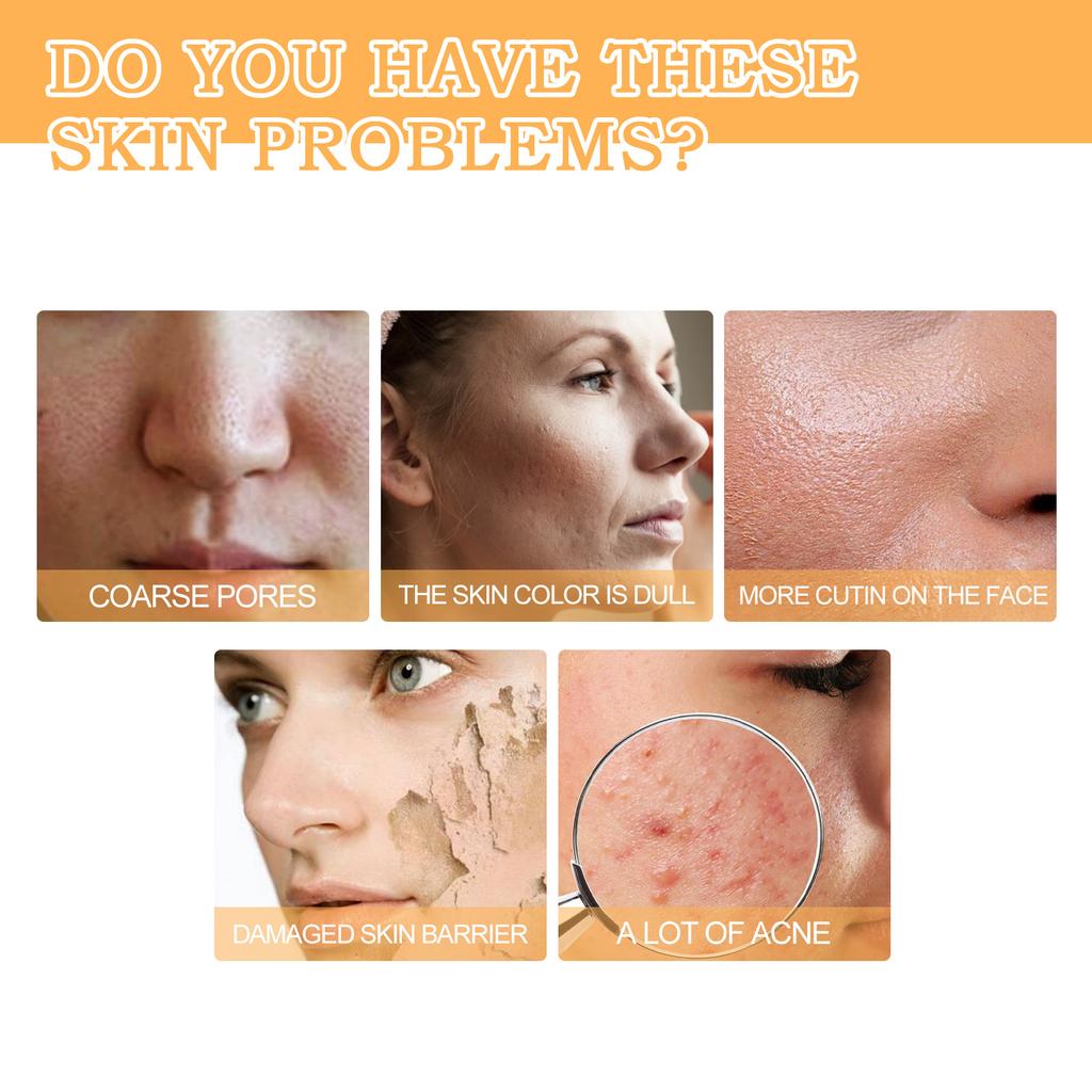 EELHOE Гликолевая кислота 7% тонер для макияжа, вода, тоник, увлажняющий балансирующий лосьон для ухода за кожей, контроль масла, гиалуроновая эссенция 100 мл